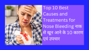 Top 10 Best Causes and Treatments for Nose Bleeding नाक से खून आने के 10 कारण एवं उपचार